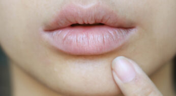 Tips Menjaga Kesehatan Bibir Agar Tidak Gelap